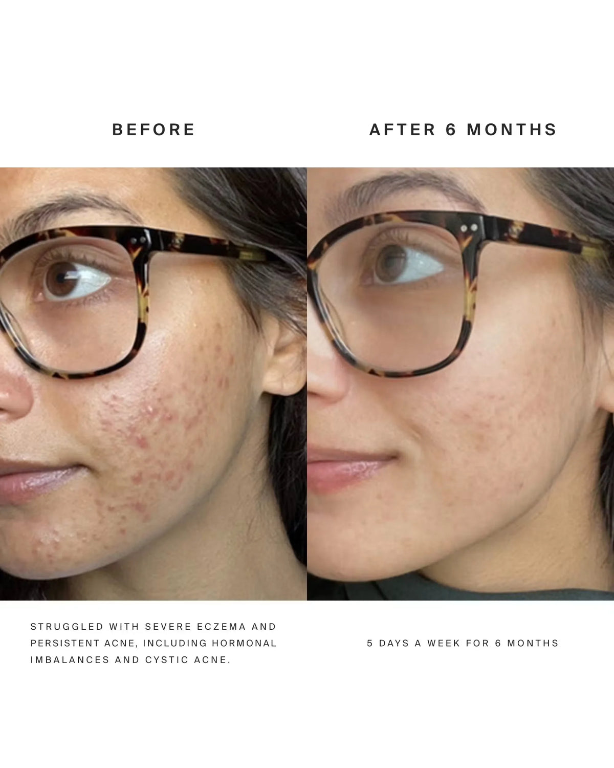 Red Light Face Mask